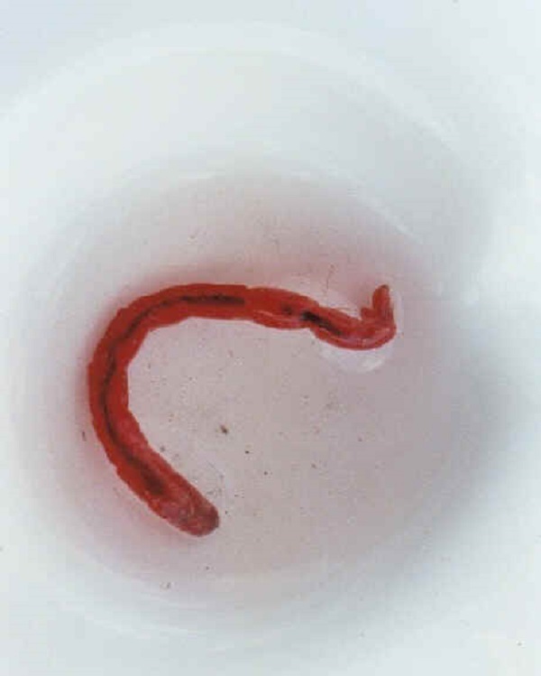 How To Get Rid Of Worms From My Toilet Quick And Simple Tips - How To Get Rid Of Red Worm In Bathroom Drain Pipe